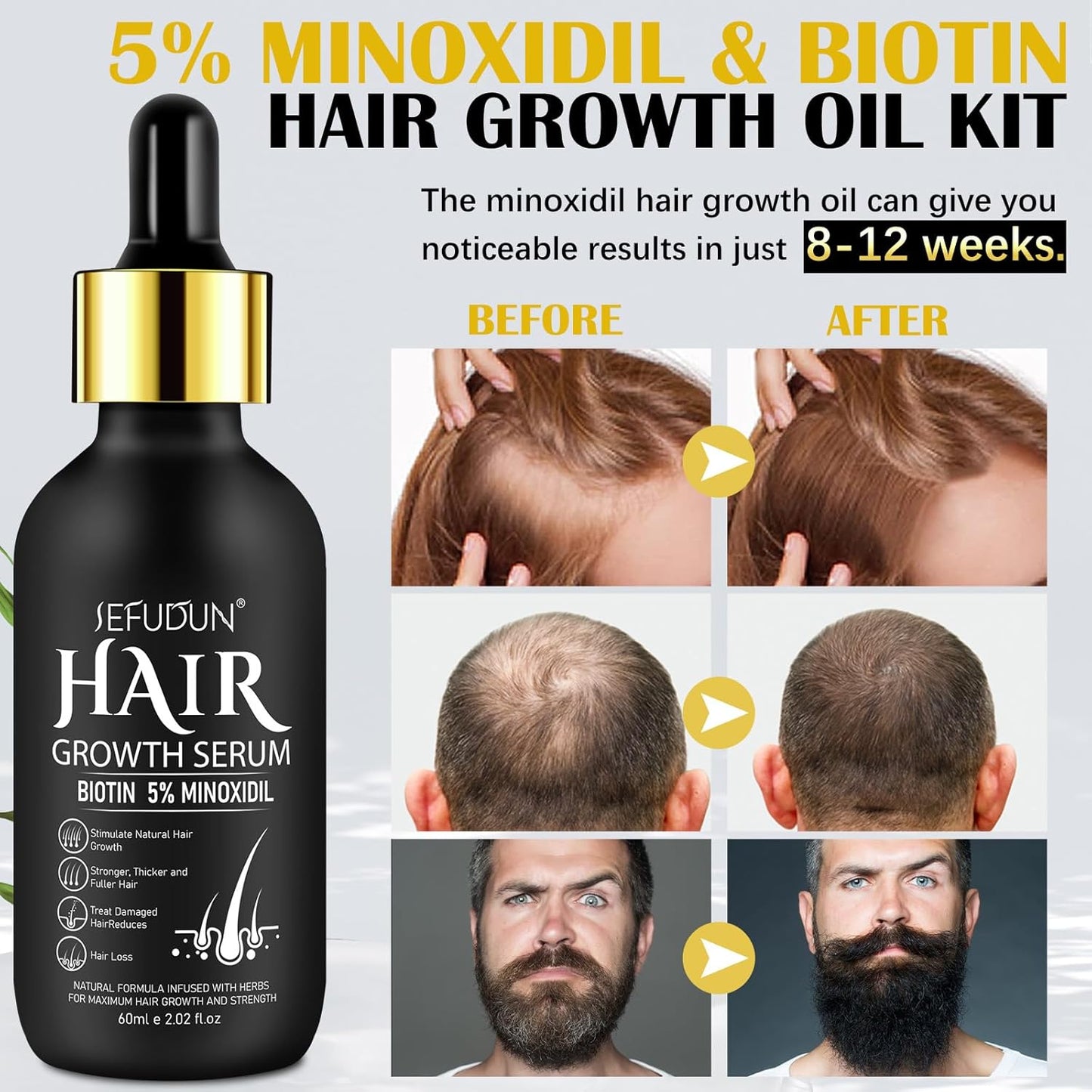 5% Minoxidil Hair Growth Oil for Men and Women - Regrowth Serum, Extra Strength Spray for Hair Loss, Thicker Healthier Hair, Beard Growth Kit, Topical...